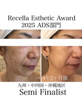 ビューティーサロン メイプルツリー/2025年セミファイナリスト受賞