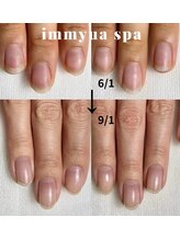 アトリエ イミュア(atelier immyua)/3ヶ月で劇的変化！美爪育成★