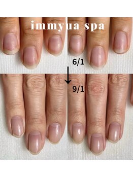 アトリエ イミュア(atelier immyua)/3ヶ月で劇的変化!美爪育成★