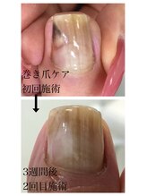 ルミエール アンド ニコ(Lumiere and nico)/