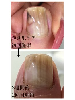 ルミエール アンド ニコ(Lumiere and nico)/