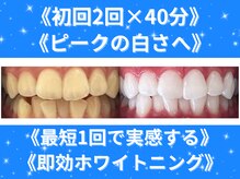 ホワイトニングショップ 四条店