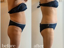 グレイティア(gratia)/リラックス痩身　