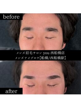 ユー 西船橋店(you)/ビフォーアフターお写真