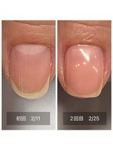 シャルマン(Charmant)/育成メニュー　