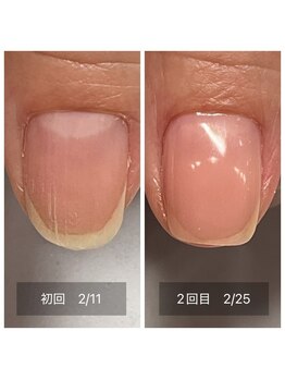 シャルマン(Charmant)/育成メニュー　