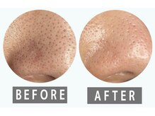 クラウドナイン(CLOUD NINE)