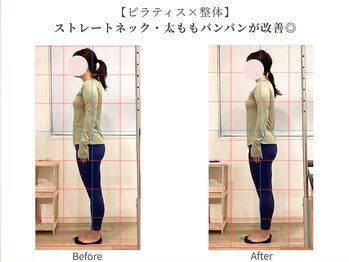 ラ ピラティス 蒲田店(La pilates)の写真/姿勢改善ならラピラティス蒲田★整体とピラティスの組み合わせで身体の歪みを根本からケア/ピラティス蒲田