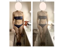 アクア エステティコ 亀有(ACQUA estetico)の雰囲気（ブライダル5回　痩身メインのお客様）
