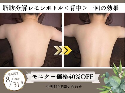 オーラコア(AURACORE)の写真