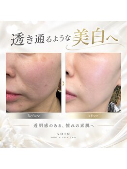 ソアン(Soin)の写真/透明感、輝き、くすみ知らずの素肌へ。