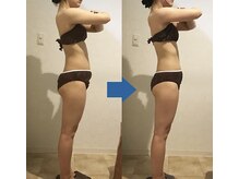 ピュアトゥルー 岐阜西店(PureTrue)/余分なお肉に高周波！ラジオ派！