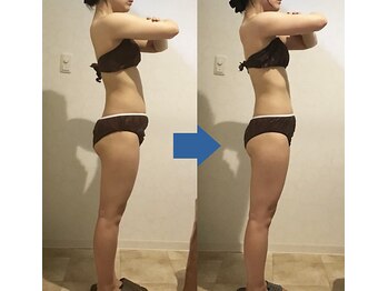 ピュアトゥルー 岐阜西店(PureTrue)/余分なお肉に高周波！ラジオ派！