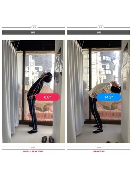 ナオル整体 大森店(NAORU整体)/20代男性、継続施術３ヶ月経過後