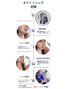 グロウ 東区香椎(GLOW)/セルフホワイトニングの流れ