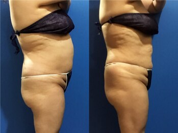 プリオール 前橋南店(Prior)/インド痩身