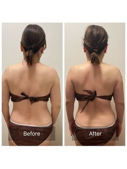 ヒール(heal)/60代のお客様