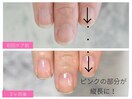 【深爪・チビ爪】でお悩みの方