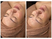 シャルマン(Charmant)/ befoer、after