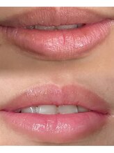 ラ ブリエ(La Briller)/唇の縦ジワケアが気になる……