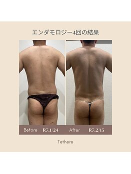 テセラ(Tethere)/エンダモロジー4回に結果!2