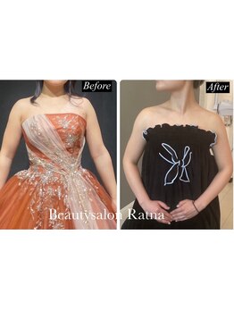 ラトナ(Ratna)/6回ブライダル痩身