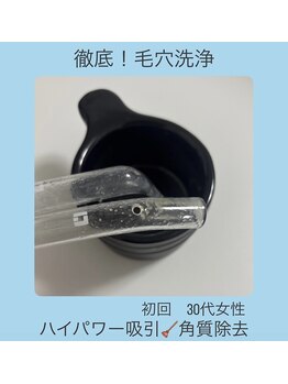 ステラ(Stella)/毛穴状態を見極めて毛穴洗浄