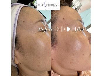 モア(more)/マリムーブフェイシャルワックス