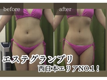 ノンノンプラス 博多(NON-NONプラス)/痩身結果