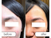 アール(R;)/眉毛でイメチェン☆