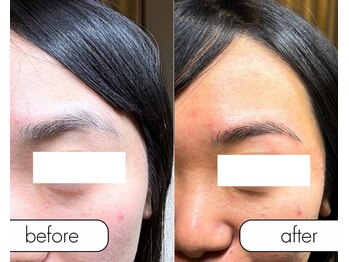 アール(R;)/眉毛でイメチェン☆