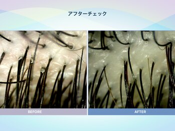 アンス(anth:)/お客様の仕上がり