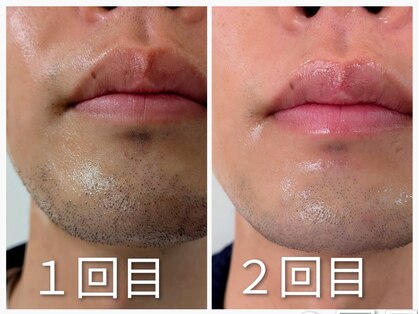 フォーティーワン(FORTY-ONE)の写真