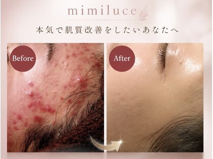 ミミルーチェ 中目黒(mimiluce)の写真