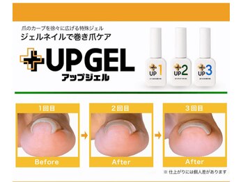 スティムネイル(Stimu nail)/【巻き爪アップジェル】