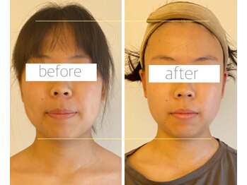 パル コルギサロン(Pal. Korugi salon)/コルギビフォーアフター