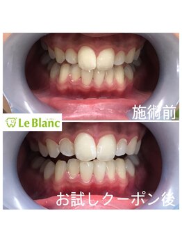 ルブラン 奈良店(Le Blanc)/お口の中は清潔に保ちましょう!