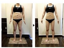 ビューティークリニックコダマ 宮崎本店/【2か月コース】M.N 様 （38歳）