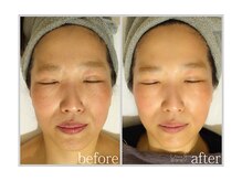 アン グレーヌ 自由が丘(unegraine)/ふっくらと若々しく♪