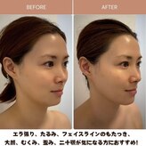 エステティック アンシア(esthetic anthea)
