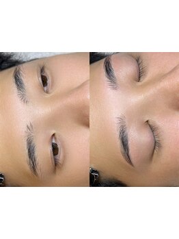 メンズフェイシャル