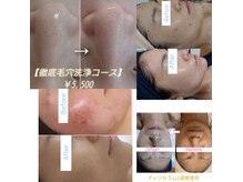 ベルブランシュ(Belle Blanche)の雰囲気（リアボーテでお肌のお悩み改善します★エクラボーテ導入サロン♪）