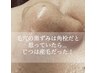 【毛穴special】人気No.1毛穴リメイク毛穴/角栓/産毛ケアWAX脱毛¥8800