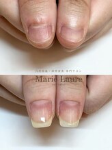 マリーロール 梅田店(Marie Laure)/深爪矯正/自爪育成/自爪風