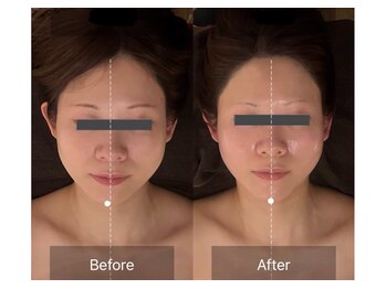 レーヴリゼ(Revelise)/頭蓋骨小顔矯正+整顔マッサージ