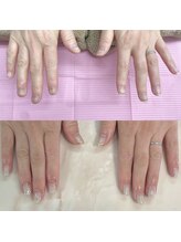 ハッカネイル(HAKKA NAIL)/