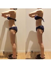 アユアランリンク 札幌店/20代/ブライダル/約4ヵ月/側面