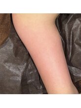 オアシスサカエ(OASIS SAKAE)/【痩身】二の腕☆