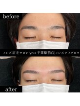 ユー 千葉駅前店(you)/ビフォ－アフター写真