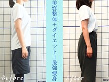 幸葉/整体/骨盤矯正/猫背矯正/小顔